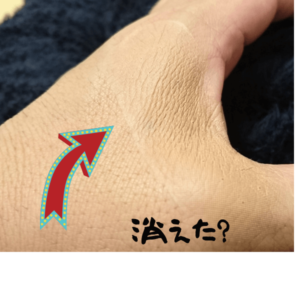 タトゥー刺青隠しシール方法